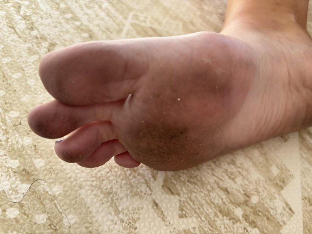 Hannas Big Soles Long Toes