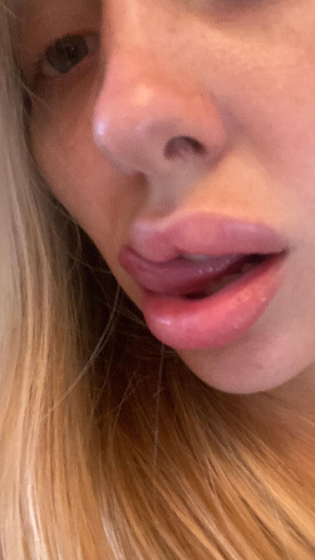 Josie adora enchimento de lábios e vender no snap