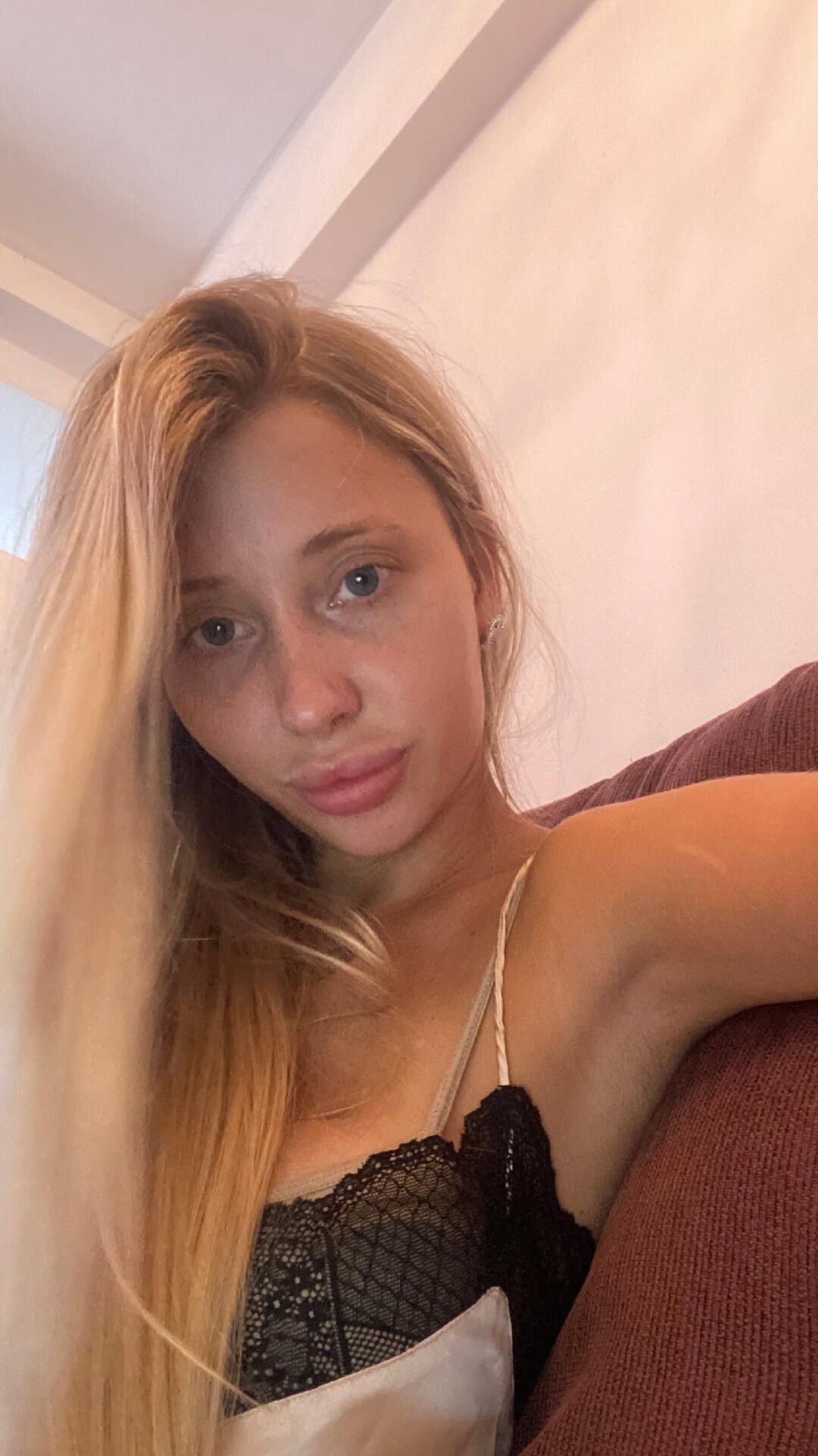 Josie adora enchimento de lábios e vender no snap