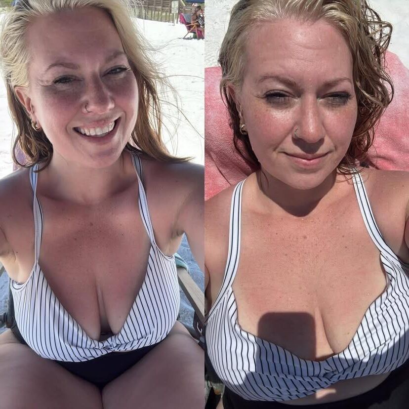  Cleavage
