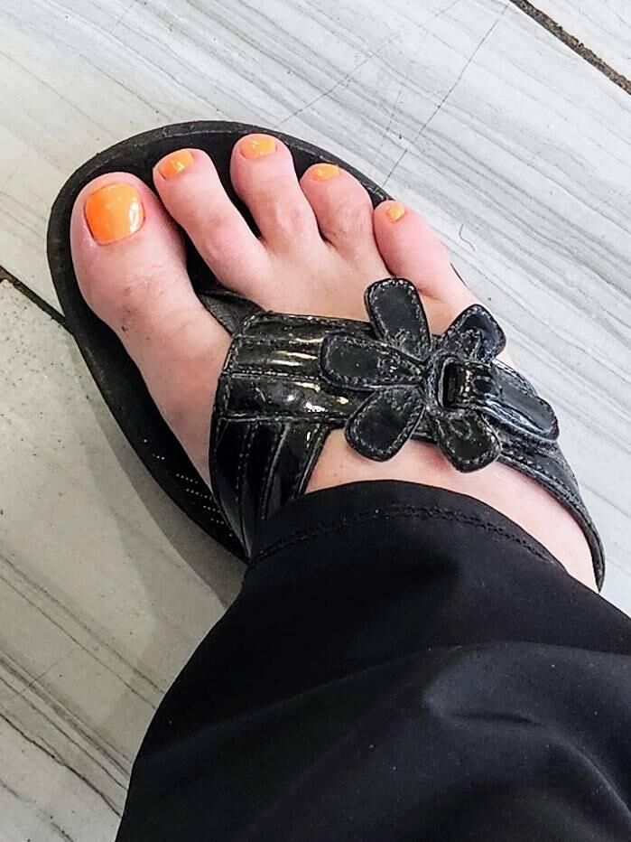  Legs, Feet, and Toes