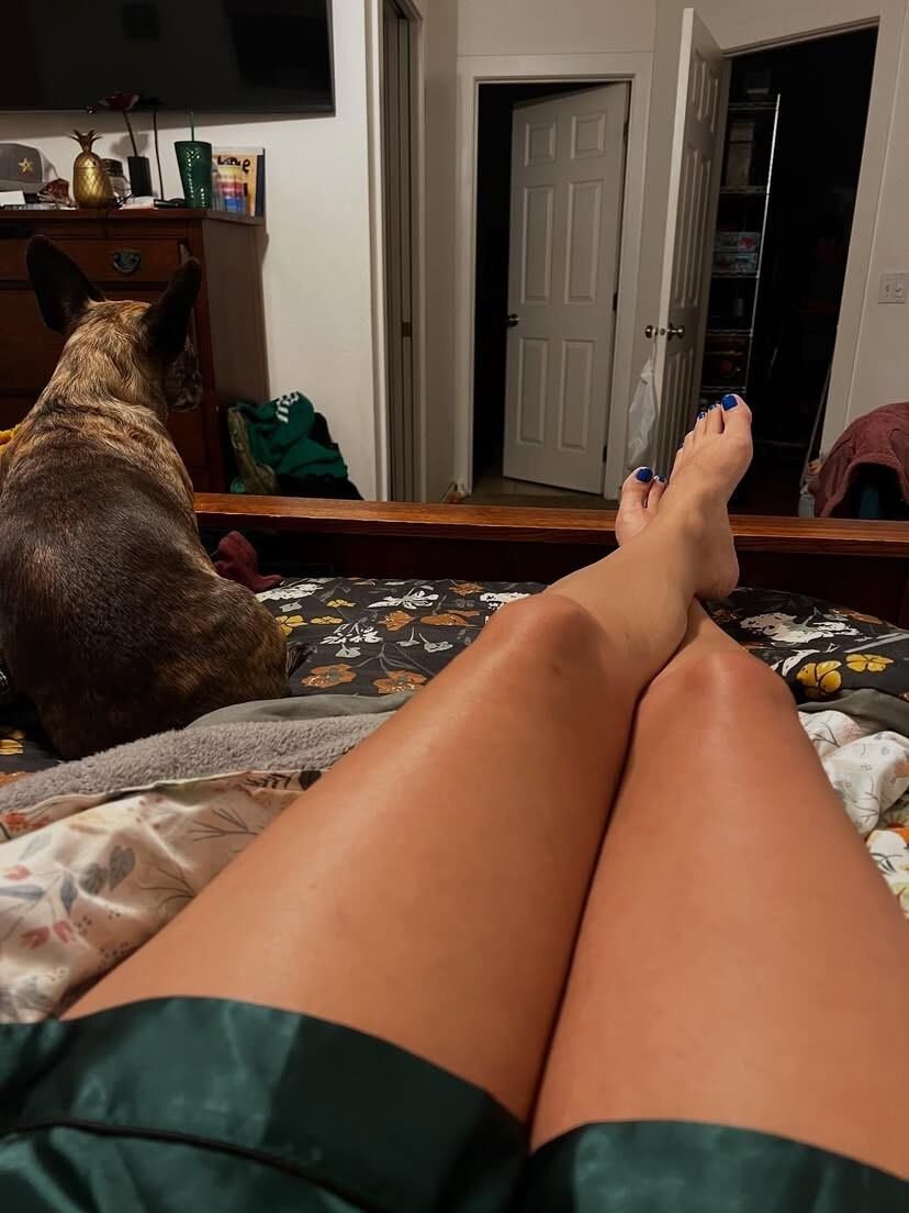  Legs, Feet, and Toes