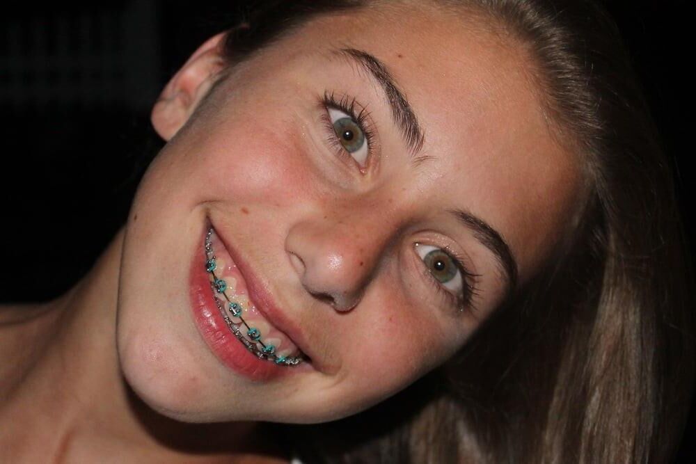 Young Sluts with Braces Have Faces Perfect Sperm Coatings