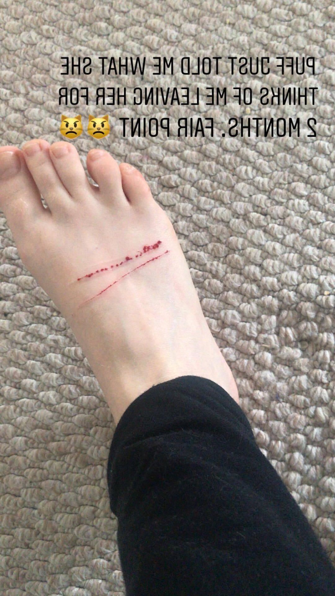 Evanna Lynch et ses pieds fantastiques
