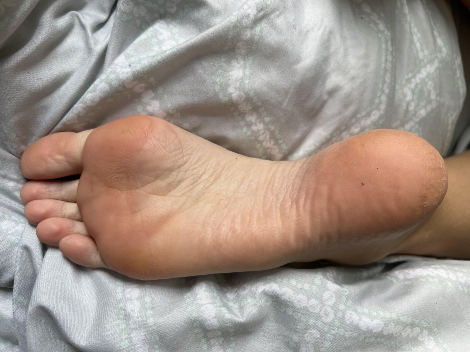 Toetoeasers taille des éclaboussures